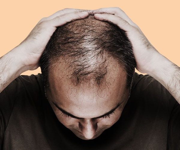 can-discovery-end-balding-and-graying-1494333252
